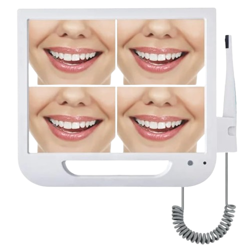 Understanding a Dental Intraoral Camera